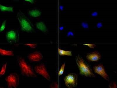 ATOX1 Antibody in Immunocytochemistry (ICC/IF)