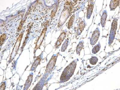 NBS1 Antibody in Immunohistochemistry (Paraffin) (IHC (P))