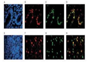 FANCD2 Antibody in Immunocytochemistry (ICC/IF)