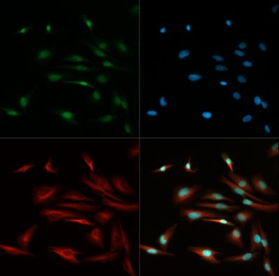 TCF7L2 Antibody in Immunocytochemistry (ICC/IF)