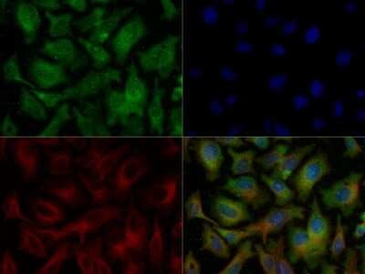 Ferroportin Antibody in Immunocytochemistry (ICC/IF)