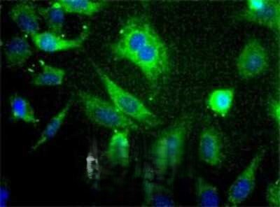 SCD Antibody in Immunocytochemistry (ICC/IF)