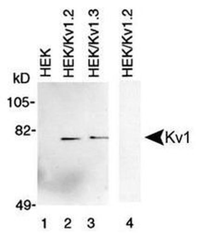 KV1.2 (KCNA2) Antibody in Western Blot (WB)