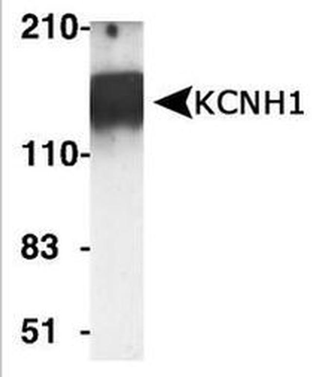 KCNH1 Antibody in Western Blot (WB)