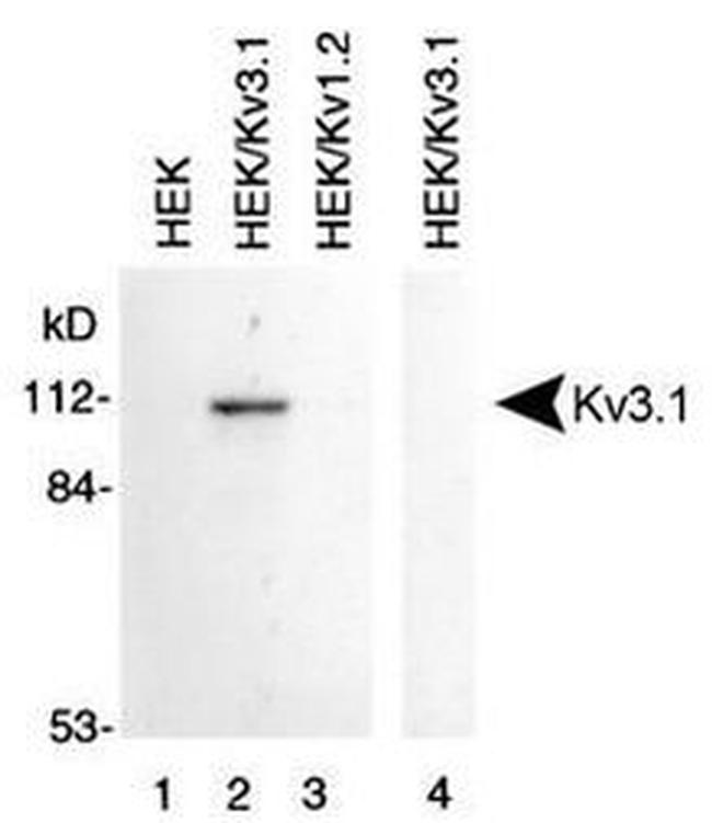 KV3.1 (KCNC1) Antibody in Western Blot (WB)