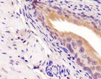 PICK1 Antibody in Immunohistochemistry (IHC)
