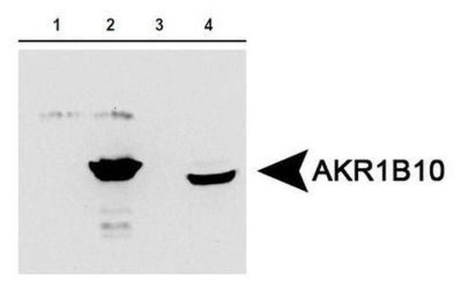 AKR1B10 Antibody in Western Blot (WB)