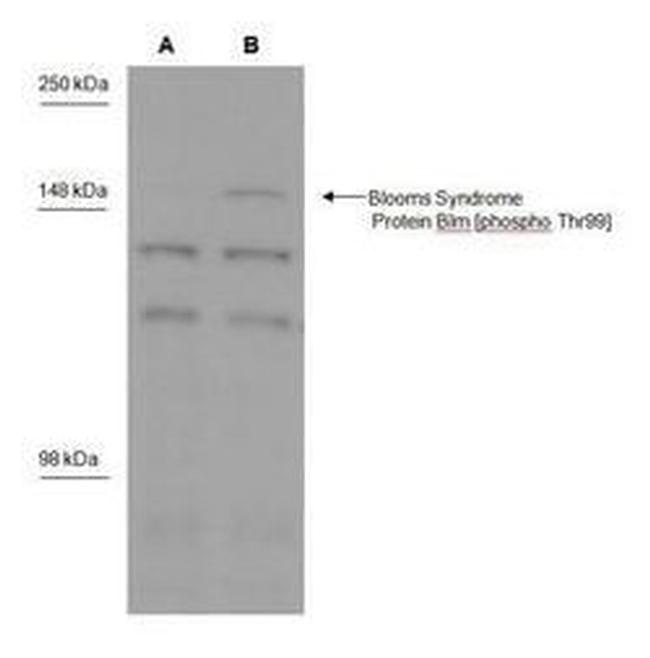 Phospho-Blooms Syndrome (Thr99) Antibody in Western Blot (WB)