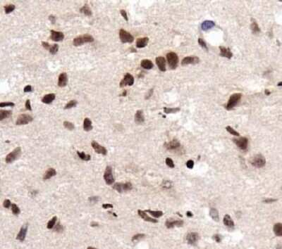 RCAN1 Antibody in Immunohistochemistry (Paraffin) (IHC (P))