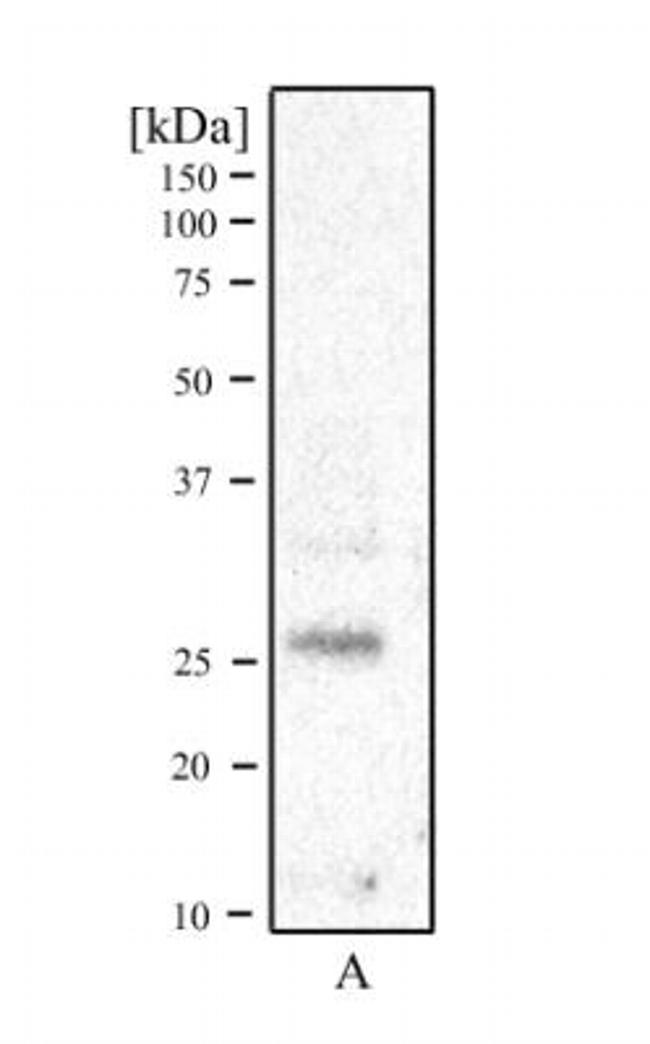 RCAN1 Antibody in Western Blot (WB)