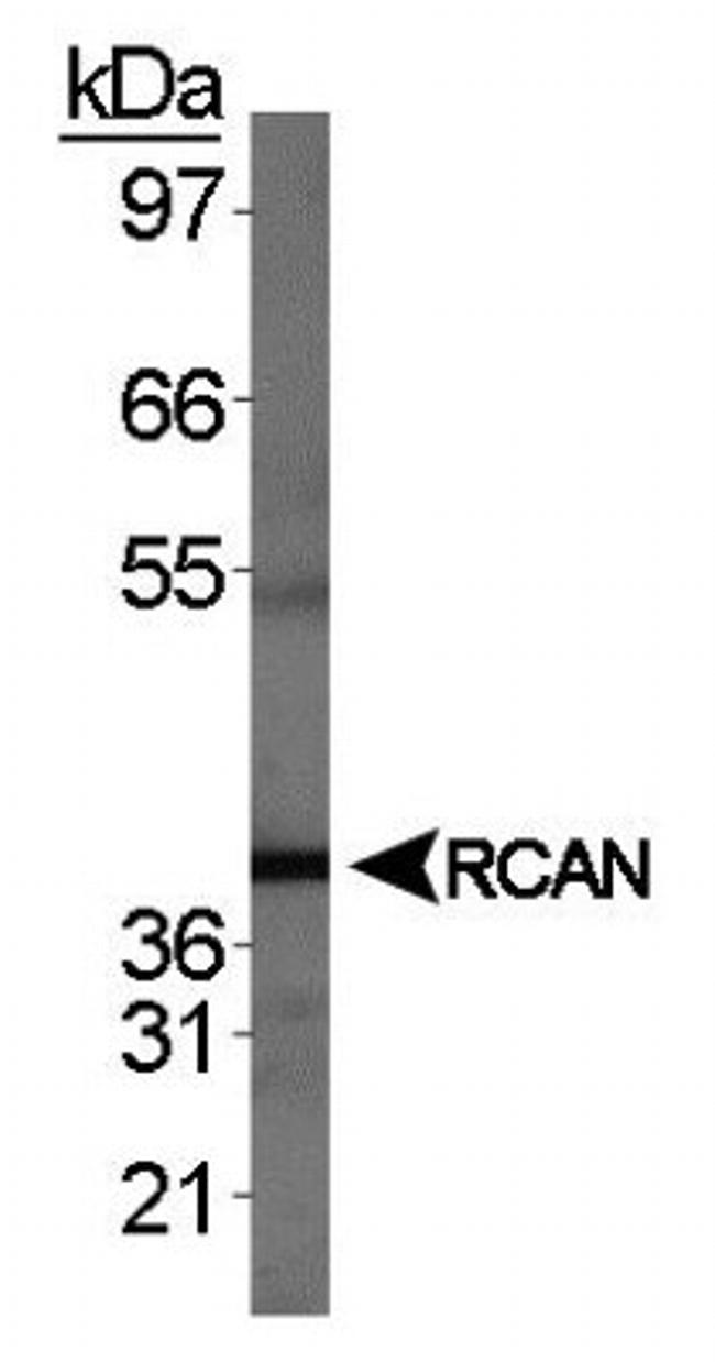 RCAN1 Antibody in Western Blot (WB)