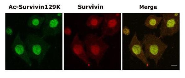 Survivin Antibody in Immunocytochemistry (ICC/IF)