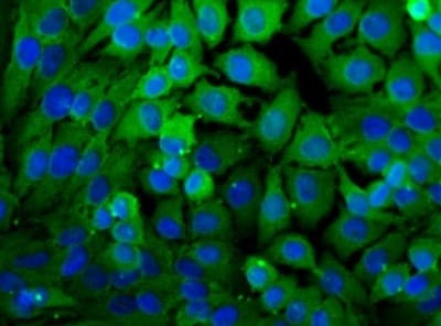 LDHA Antibody in Immunocytochemistry (ICC/IF)