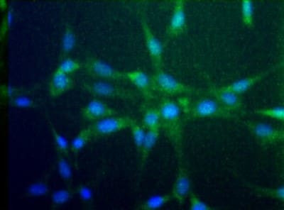 CCR2 Antibody in Immunocytochemistry (ICC/IF)