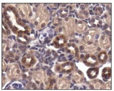 GLUT4 Antibody in Immunohistochemistry (Paraffin) (IHC (P))