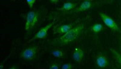 CDX1 Antibody in Immunocytochemistry (ICC/IF)