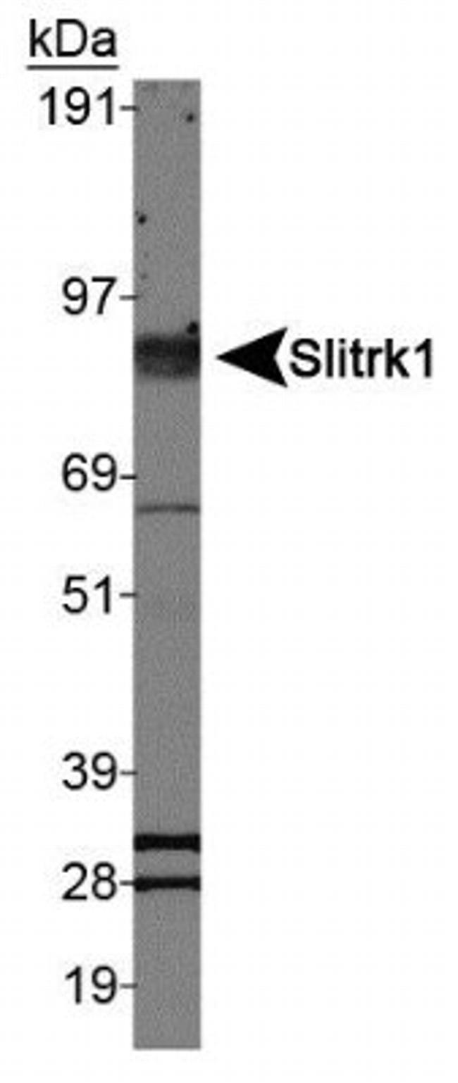 SLITRK1 Antibody in Western Blot (WB)