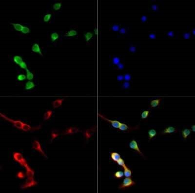 Nkx6.1 Antibody in Immunocytochemistry (ICC/IF)