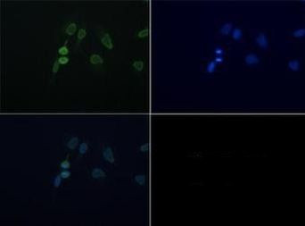 FUS Antibody in Immunocytochemistry (ICC/IF)