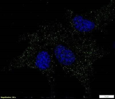 GPR155 Antibody in Immunocytochemistry (ICC/IF)
