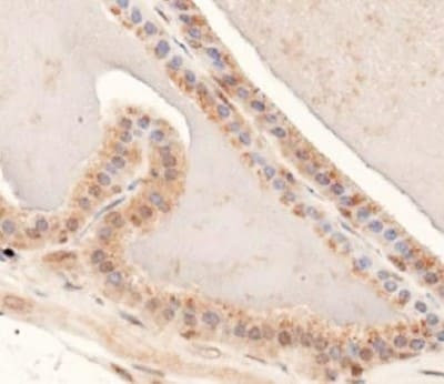 MUC4 Antibody in Immunohistochemistry (Paraffin) (IHC (P))