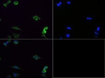 SDHA Antibody in Immunocytochemistry (ICC/IF)
