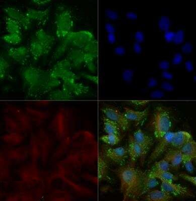 TRAIL-R2 (DR5) Antibody in Immunocytochemistry (ICC/IF)