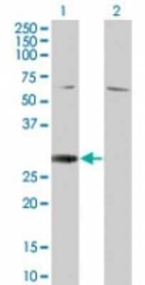 RGS18 Antibody in Western Blot (WB)
