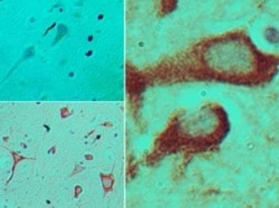 TICAM2 Antibody in Immunohistochemistry (Paraffin) (IHC (P))
