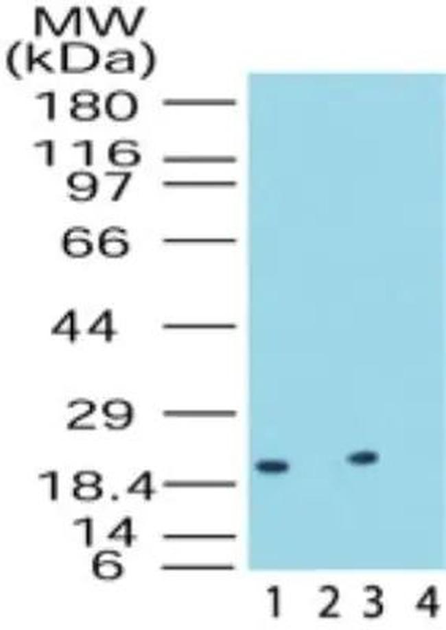 DUSP18 Antibody in Western Blot (WB)