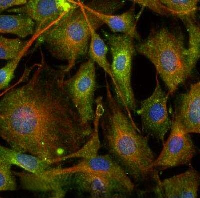 RAB7 Antibody in Immunocytochemistry (ICC/IF)