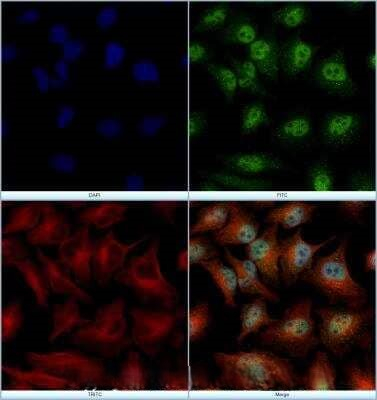 Sorcin Antibody in Immunocytochemistry (ICC/IF)