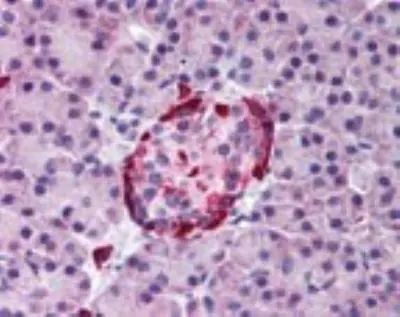 EphA2 Antibody in Immunohistochemistry (Paraffin) (IHC (P))