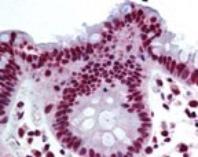 THRAP3 Antibody in Immunohistochemistry (Paraffin) (IHC (P))
