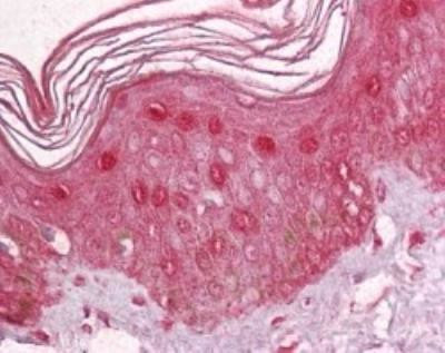 Pokemon Antibody in Immunohistochemistry (Paraffin) (IHC (P))