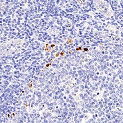 FOXP3 Antibody in Immunohistochemistry (Paraffin) (IHC (P))