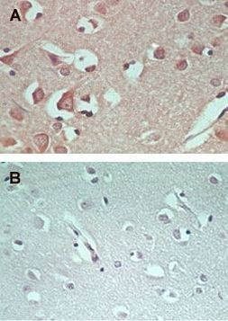 AMPD1 Antibody in Immunohistochemistry (IHC)