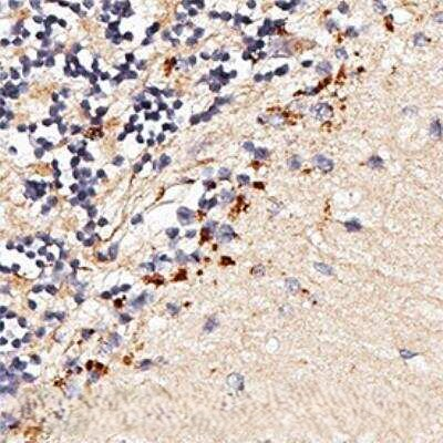 TLR7 Antibody in Immunohistochemistry (Paraffin) (IHC (P))