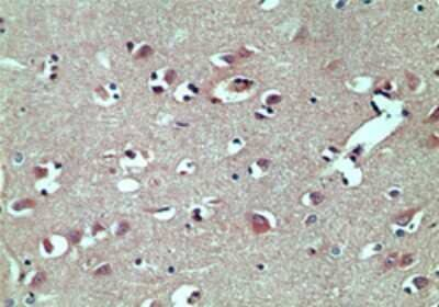 TRBP Antibody in Immunohistochemistry (Paraffin) (IHC (P))