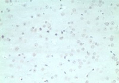 ARHGAP20 Antibody in Immunohistochemistry (Paraffin) (IHC (P))