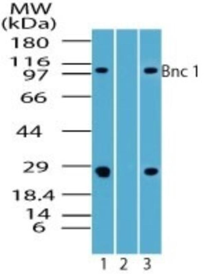 BNC1 Antibody in Western Blot (WB)