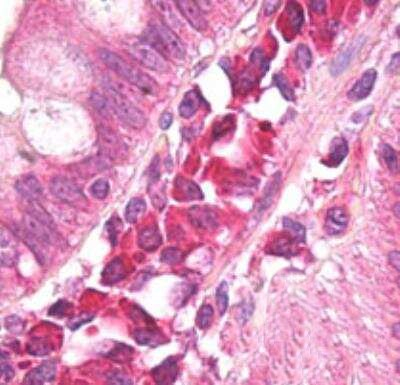 AMBRA1 Antibody in Immunohistochemistry (Paraffin) (IHC (P))