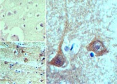 Prosapip2 Antibody in Immunohistochemistry (Paraffin) (IHC (P))