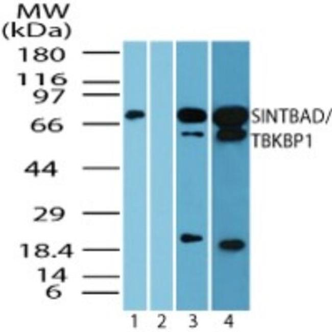 Prosapip2 Antibody in Western Blot (WB)