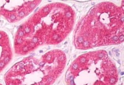 GNPDA1 Antibody in Immunohistochemistry (Paraffin) (IHC (P))