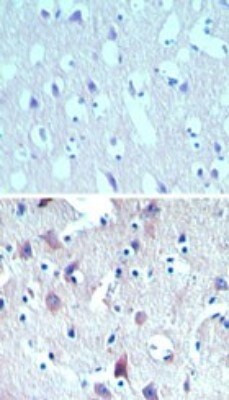 C8orf55 Antibody in Immunohistochemistry (Paraffin) (IHC (P))