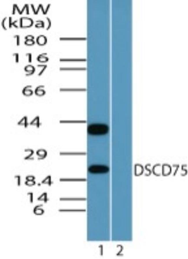 C8orf55 Antibody in Western Blot (WB)