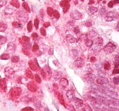 CNOT4 Antibody in Immunohistochemistry (Paraffin) (IHC (P))