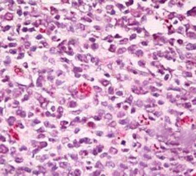 SWAP70 Antibody in Immunohistochemistry (Paraffin) (IHC (P))