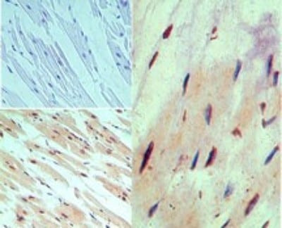 MUC13 Antibody in Immunohistochemistry (Paraffin) (IHC (P))
